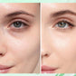 Aufhellende Gesichtscreme mit Retinol und Kollagen